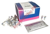 Набор экспресс-тестов на COVID-19 и наличие антител Zybio SARS-Cov-2 IgG/IgM Antibody Assay Kit 25 шт. - БумерангШоп.РФ - Всё для торговли и общепита